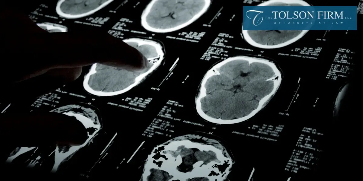Best Atlanta Birth Brain Injury Lawyer