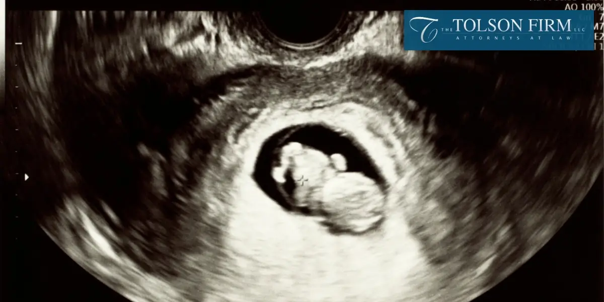 Respected Columbus Fetal Death Lawyer