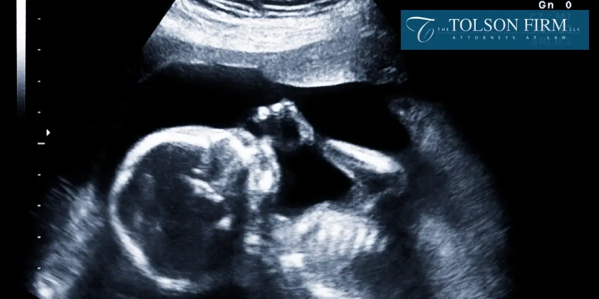 Skilled Macon Fetal Death Lawyer