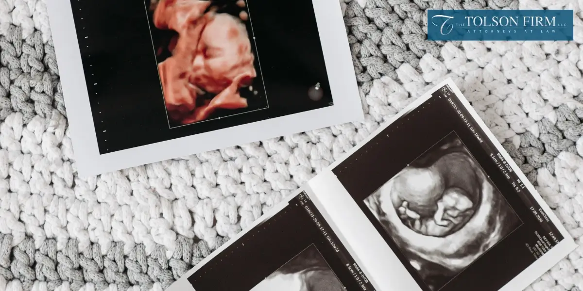 Top-rated Alpharetta Fetal Death Lawyer Top-rated Alpharetta Fetal Death Lawyer