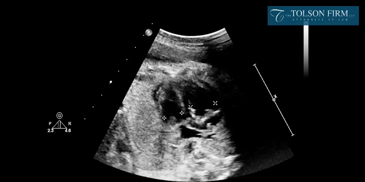 Best Gainesville Fetal Death Lawyer Best Gainesville Fetal Death Lawyer