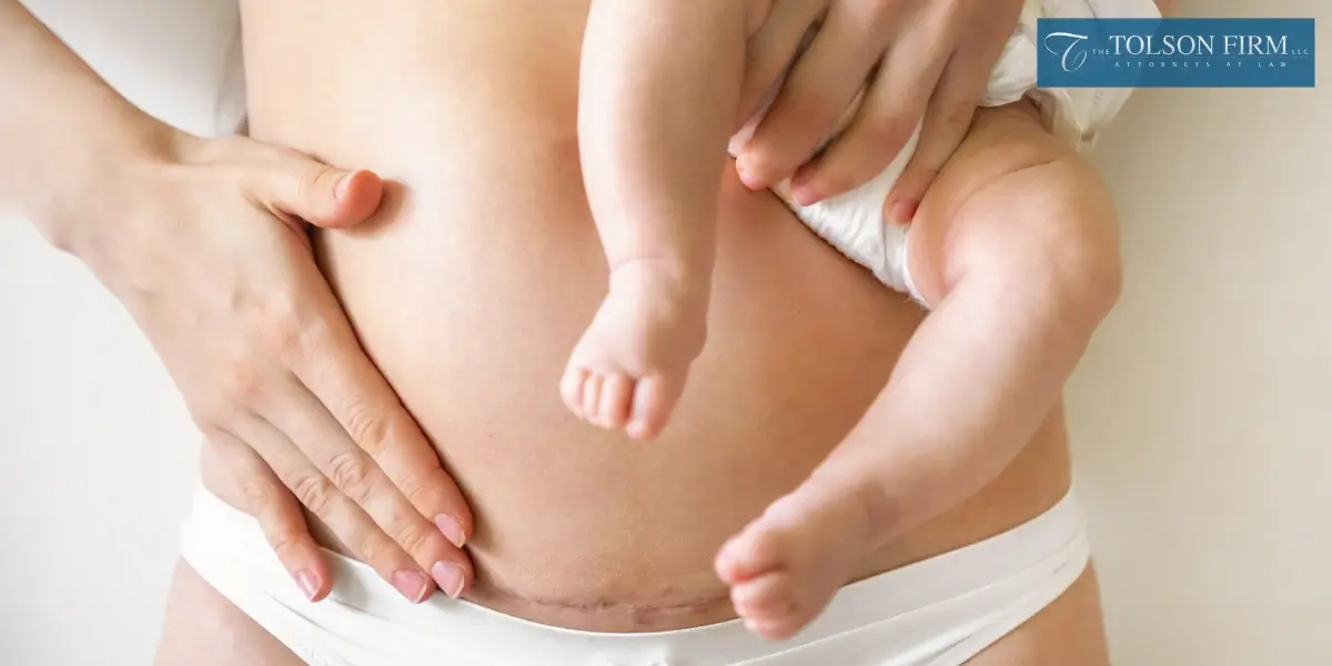 Top-rated Marietta Birth Injury Attorney